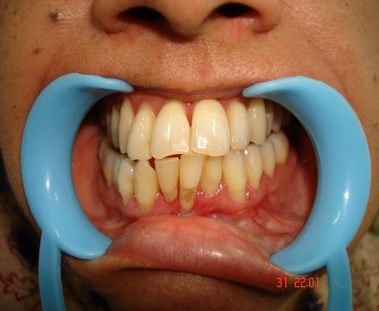 Best dentist nearby me