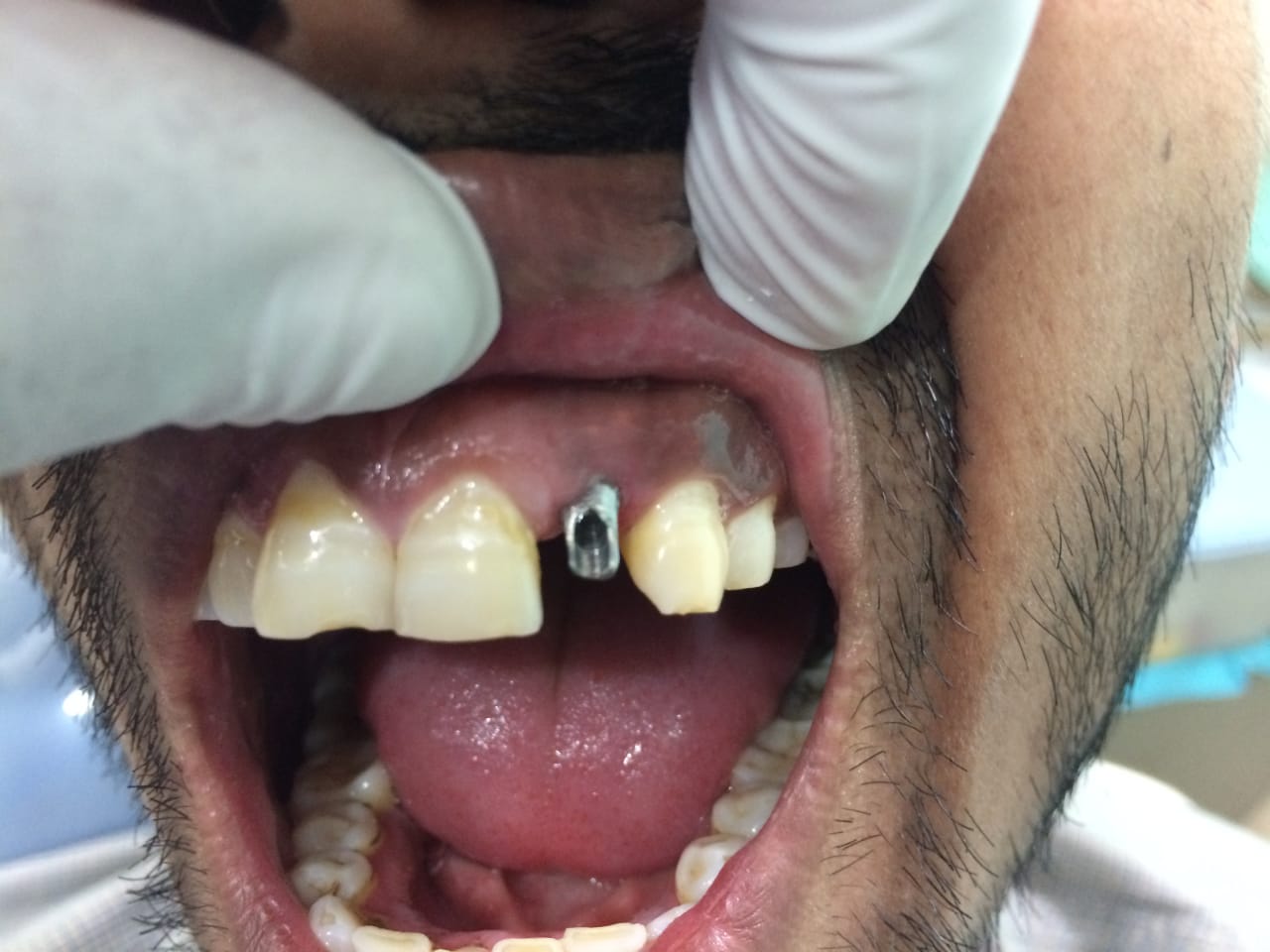 Delhi best dentist