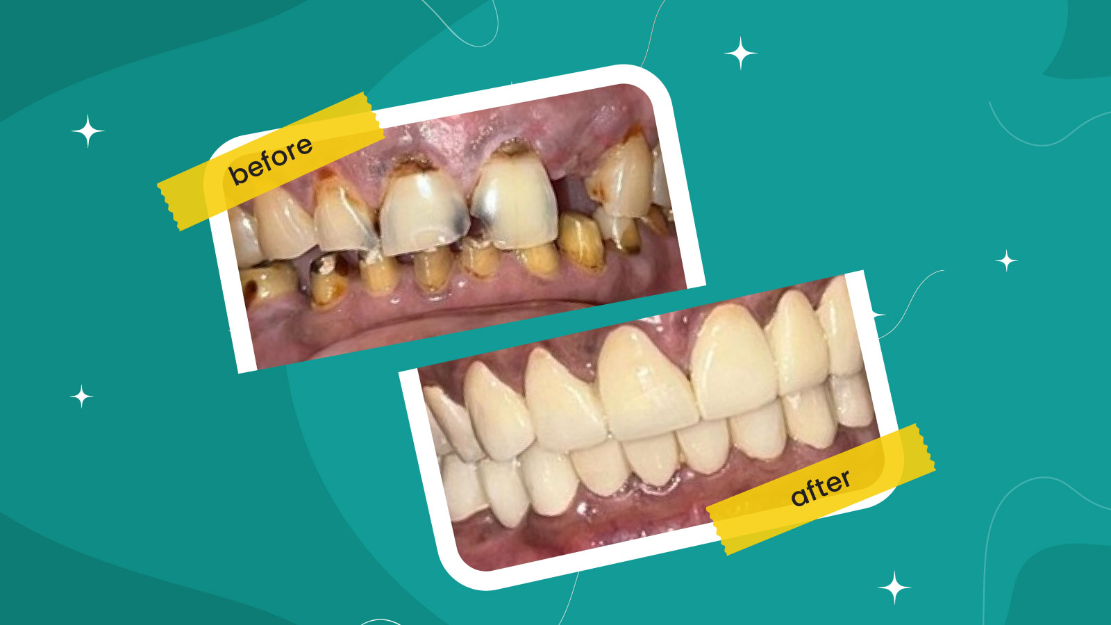 3D X ray CBCT