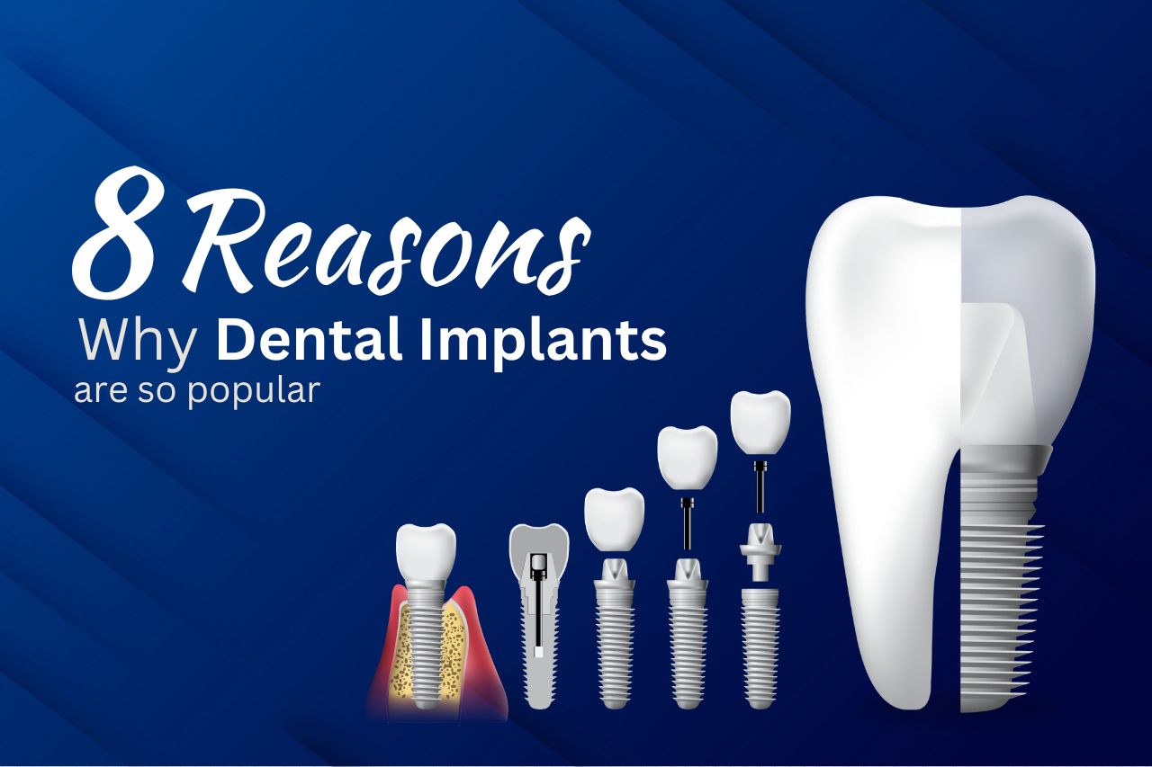 Reasons Why Dental Implants Are So Popular