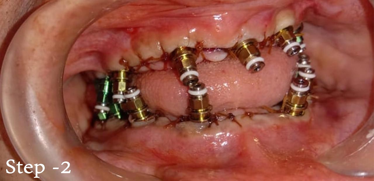 smritiraj dentistry